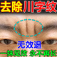 川字紋去除神器填充抬頭紋去除男女重度去皺紋去法令紋貼睡覺貼膏 試用裝【去皺膏】