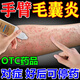 克林霉素甲硝唑搽劑 手臂毛囊炎長痘痘胳膊上的小疙瘩 手臂毛囊炎專用藥手臂長疙瘩黑點(diǎn)皮膚用藥抗菌 1盒裝【國藥準(zhǔn)字】