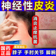 脖子上長的癬 治療神經性皮炎專用藥 皮膚瘙癢抓出血皮炎濕疹真菌感染皮癬全身止癢抗菌藥膏 曲咪新乳膏 1盒裝【治神經性皮炎 止癢抗菌】