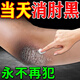胳膊肘黑色素沉淀去除肘部去黑膝蓋手肘關(guān)節黑色素快速去除藥膏 一盒裝