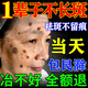 377美白祛斑霜去斑黃褐斑雀斑曬斑美白精華面霜水乳男女士強(qiáng)效第一名 1盒【體驗(yàn)試用】十支