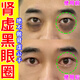 妙誘黑眼圈重度去除專(zhuān)用的藥男士嚴(yán)重熬夜祛除眼袋淡化黑色素眼霜眼膜 100%祛除黑眼圈1瓶裝