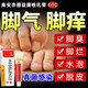 治腳氣藥止癢脫皮爛腳丫真菌感染根部治角化型干裂腳氣腳后跟干裂腳臭汗腳皮膚科用藥曲安奈德益康唑乳膏 1盒【治腳氣的藥】