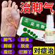 足光散治腳氣腳臭泡腳止癢脫皮爛腳丫真菌感染根特專(zhuān)用效藥治角化型干裂爛腳丫汗腳脫皮糜爛腳趾縫爛癢發(fā)白 【腳趾縫爛癢發(fā)白】2盒+鹽酸特比.萘芬噴霧