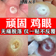 雞眼貼去根去肉刺刺猴無痛脫落雞眼去除特新效藥膏連根拔去腳底老繭去硬皮角質(zhì)跖疣皮膚用藥水楊酸苯酚貼膏 1盒【皮膚增厚疼痛】嚴重建議多盒使用
