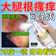 股蘚大腿內側真菌感染腹股溝股癬膏大腿根內測潮濕瘙癢癬藥水噴霧專(zhuān)用藥真菌感染皮膚用藥鹽酸特比萘芬噴霧劑 1盒【股癬大腿內側 】【視覺(jué)特效】