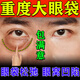 艾妙松眼袋貼眼袋去除神器去眼袋嚴(yán)重中老年消重度眼袋專用除皺紋眼袋霜 1盒裝【每盒60貼】