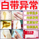 白帶丸治多種婦科炎癥外陰瘙癢婦科專(zhuān)用藥 白帶多發(fā)黃有異味內褲濕濕用什么藥婦科用藥 非處方藥 3盒療程【白帶色發(fā)黃綠色有異味 】不想在反復