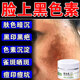 百約王臉上黑色素沉淀去除膏黑斑點(diǎn)黑色素臉上黑印淡化黑色素沉淀專用 1盒裝