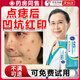 點(diǎn)痣后去疤痕修復非要水無(wú)痕激光去痣疤痕臉部凝膠點(diǎn)痣后去紅印黑印修復凹陷 單盒體驗裝