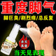 嚴(yán)重腳氣藥止癢脫皮爛腳丫真菌感染根藥治腳氣止癢殺菌專用藥腳氣噴劑腳臭專用藥鹽酸特比萘芬噴霧劑皮膚用藥 3瓶裝【腳臭脫皮水泡糜爛】腳氣去藥根專用視覺(jué)特效