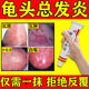 龜頭炎專(zhuān)用藥真菌感染包皮炎珍珠疹念珠菌男人私處紅腫瘙癢龜頭癢有紅點(diǎn)用什么藥真菌感染皮膚用藥曲咪新乳膏 1盒【龜頭炎專(zhuān)用藥】男科用藥