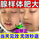 林沛堂兒童鼻炎鼻竇炎腺樣體肥大兒童用藥中貼張口呼吸矯正貼器閉嘴神器 【單盒裝】 1盒*10貼 100%特效專冶貼