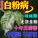 幸福樹(shù)白粉病專(zhuān)用藥葉子干枯落葉霉斑黑斑炭疽病專(zhuān)用營(yíng)養液 買(mǎi)二發(fā)三
