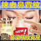 鼻背紋去除神器消除修復(fù)臉上鼻梁橫紋貼淡化山根眉間抬頭橫行皺紋祛額頭肌肉川字紋貼面霜 1瓶【體驗(yàn)裝】