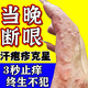 天下草民手指長小水泡手指汗皰疹手指真菌感染手指癢起小水泡止癢抑菌膏 1盒裝【體驗裝】效果少