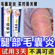 腿部毛囊炎大腿毛囊炎腿上紅疙瘩瘙癢藥膏腿上長痘痘雞皮膚疙瘩毛周角化毛孔堵塞腿上干燥起皮O4 單盒【體驗裝】毛囊炎專用膏