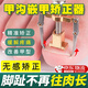 甲溝矯正器嵌甲矯正器卷甲糾正神器防腳指甲長(zhǎng)肉里專用修腳工具炎 金色（透明膠盒）包裝/一盒裝