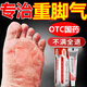 達(dá)克寧腳氣藥止癢脫皮爛腳丫真菌感達(dá)克寧硝酸咪康唑乳膏達(dá)克寧軟膏治腳氣腳氣腳臭100發(fā)貨特新效期專用 1盒裝【硝酸咪康唑乳膏】輕度腳氣 癢的難受