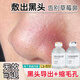 fUT敷出黑頭 去黑頭導(dǎo)出液收縮毛孔精華粗大清潔閉口粉刺T區(qū)男女士 去黑頭縮毛孔50ml*2