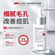 ning進(jìn)口水楊酸祛痘精華液30ml淡化學(xué)生痘印痘坑修復(fù)收縮毛孔男女士