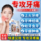 BEAI牙疼噴霧牙痛噴劑牙齦腫痛牙神經(jīng)痛口氣清新劑噴霧70ml