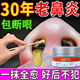 鼻竇炎專用的藥100%根i治日本進口鼻炎貼過敏性鼻炎鼻竇炎鼻塞通 特效一盒裝【鼻炎包冶好】