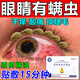 京珠堂茶樹(shù)精油眼部除螨眼貼醫用眼睛干澀模糊疲勞有異物螨蟲(chóng)濕巾眼部貼 3盒價(jià)發(fā)5盒