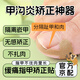 甲溝炎矯正器甲溝炎墊片正甲貼片甲蓋內嵌神器隔離腳趾甲填充墊片 40貼/10張【矯正嵌甲 不扎肉】