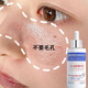 傾齡毛孔收縮精華液粗大修復(fù)細(xì)致縮小控油補(bǔ)水保濕去黑頭閉口粉刺原液 2瓶裝【入門級(jí)毛孔改善】