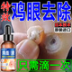 藤原石川制薬雞眼貼雞眼膏去根肉刺藥膏無(wú)痛脫落連根拔雞眼膏貼除水楊藥酸軟膏50%去雞眼液去腳底老繭去硬皮跖疣腳底趾疣去根hpv跖疣貼膏 【買(mǎi)2送1】中度雞眼 增厚 疼痛 繭子跖疣雞眼100%特效專(zhuān)用
