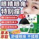 眼角癢消炎止癢越揉越癢眼藥水抗過敏性結(jié)膜炎止發(fā)癢總?cè)嘌鄣窝垡?花粉過敏殺菌干澀紅血絲眼藥水 過敏性鼻炎引起的眼睛癢眼藥水