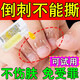 手指倒刺修復油兒童孩子手指倒刺護理指甲營(yíng)養液指甲邊干裂蛻皮油 倒刺修復液【一盒】