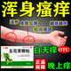 全身皮膚癢吃什么藥血熱皮膚癢用藥血熱型濕疹內(nèi)服藥皮膚紅斑瘙癢越抓越癢清熱涼血止癢藥五花茶顆粒 1盒【血熱型濕疹】建議多盒效果更佳 國藥準(zhǔn)字 正品保證