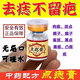 點痣膏美容的院專用官的方正品點疣藥水去痣點痣膏疤痕修復液醫(yī)用 一盒裝