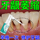 牙齦萎縮修復(fù)再生噴劑牙根外漏重度牙周炎牙齒松動(dòng)出血腫痛長(zhǎng)膿包 一盒體驗(yàn)裝【牙齦出血】特快發(fā)貨