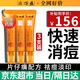 片仔癀祛痘膏【京超7倉發(fā)貨】祛痘印痘坑修復(fù)去痘紅腫淡化痘印女男士 （大周期裝）片仔癀祛痘膏*3支裝