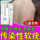 傳染性軟疣可搭藥兒童水猴子病毒性去軟疣工具醫用級小兒成人軟疣去除神器 單盒體驗裝