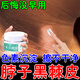 脖子黑色素沉淀男女肥胖黑棘皮腋下膝蓋胳膊肘關(guān)節黢黑久坐屁股大腿內側黑洗不掉曬后全身發(fā)黑淡化黑雞皮膏w 單盒裝