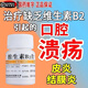維生素b2片+b6可治療反復(fù)口腔潰瘍舌頭長(zhǎng)泡青少年兒童唇干癥炎助睡眠治防脫發(fā)脂溢性皮炎回奶口臭產(chǎn)后 1盒維生素b2片【助睡眠或口腔潰瘍】 治療維生素缺乏癥引起的多種癥狀