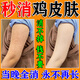 巖井昃弘雞皮膚去除神器去雞皮膚毛囊角質(zhì)疙瘩大腿胳膊皮膚干燥兒童身體乳 單盒裝【雞皮膚克星】
