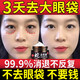 絲幕眼袋去除神器眼袋嚴重問(wèn)題中老年男女士毒蛇肽眼霜黑眼圈嚴重眼袋 1瓶裝【體驗裝】