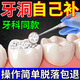 補牙齒神器材料永久自己在家補牙齒修復填充自己補牙修復樹(shù)脂 單瓶裝【體驗裝】補5-10顆牙
