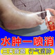 骉祥腳腫消腫的藥治老人去下肢小腿部水腫浮腫利尿排水特效神器療z 300ml