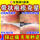 萊覽奧蓋帶狀皰疹后遺癥神經(jīng)痛用藥斷根蛇盤瘡汗皰疹濕疹止癢去根藥膏進(jìn)口 1盒【腰背手上起小水泡紅疹】
