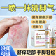 同仁堂腳氣噴劑止癢脫皮腳汗水泡型腳癢腳臭汗噴霧狼毒噴劑60ML+20ML