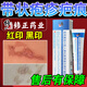 修正帶狀皰疹疤痕修復(fù)藥膏后黑色素沉淀專(zhuān)用膏黑印紅斑增生肉芽瘢痕膏 單盒【體驗(yàn)裝】