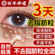 汗管瘤脂肪粒眼部專(zhuān)用去除藥膏顆粒清肌眼霜去脂肪粒藥膏祛油脂粒 一支裝