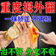 北京同仁堂拇指外翻膏藥治大拇指外翻矯正器腳骨外翻拇囊炎關(guān)節脹痛醫用藥膏 買(mǎi)2送1【99%選擇】發(fā)貨特效快