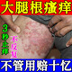 APGMA大腿內(nèi)側(cè)瘙癢紅疹越抓越癢股癬蘚藥膏大腿內(nèi)側(cè)真菌感染腹股溝股癬專用的藥膏大腿根內(nèi)側(cè)黑色素去除大腿根內(nèi)測(cè)潮濕瘙癢股癬發(fā)黑 【單盒裝】